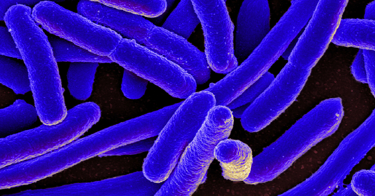 Indian Origin Scientist Develop Cheap Solar Cells Made Out Of e.coli Bacteria