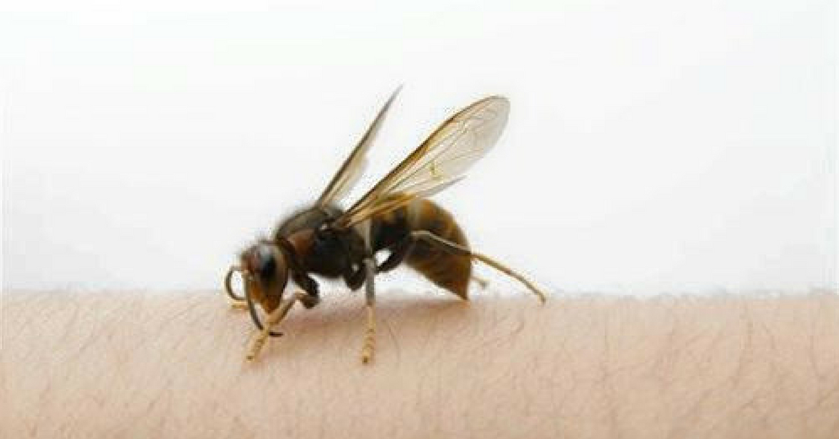 A bee sting can be painful, and first aid can alleviate some of the suffering. Image Credit: Pestworld