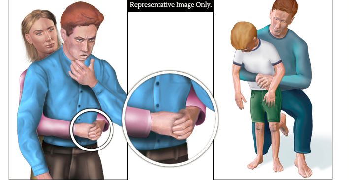 First aid for choking aims to dislodge the stuck particle. Representative Image Only. Image Credit: Wikimedia Commons